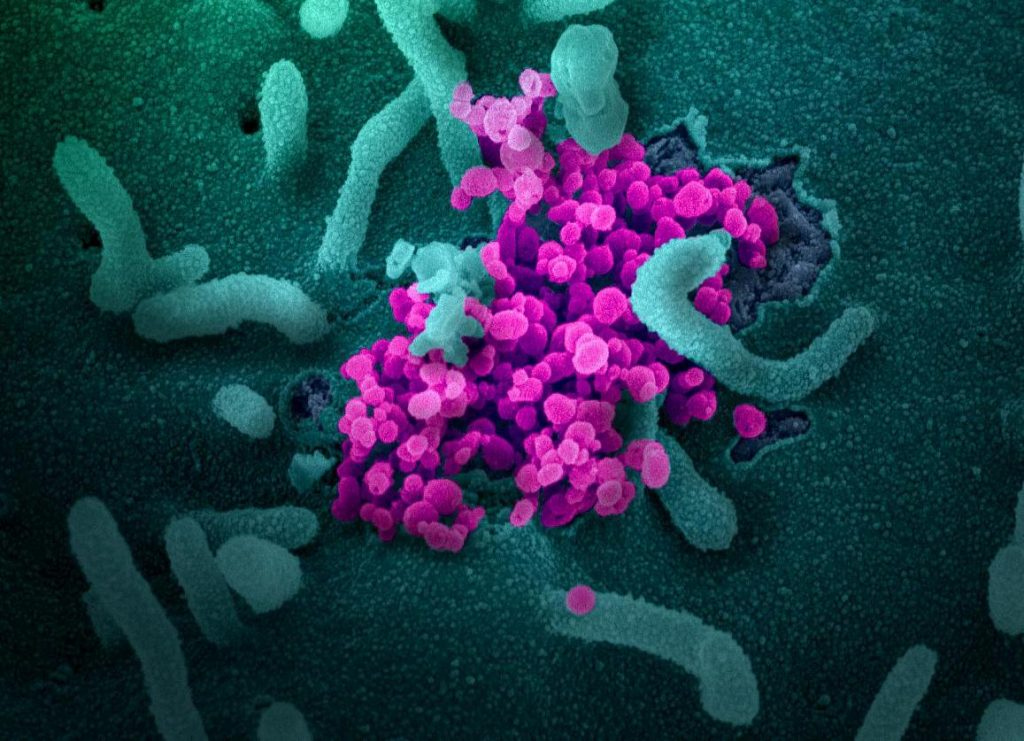 SARS-CoV-2, also known as 2019-nCoV, is the virus that causes COVID-19. The virus shown was isolated from a patient in the U.S. (Credit: NIAID-RML)