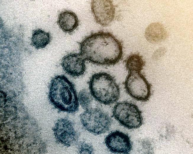 A transmission electron microscope image shows SARS-CoV-2 -- also known as 2019-nCoV, the virus that causes COVID-19 -- isolated from a patient in the US. (Photo: NIAID-RML)