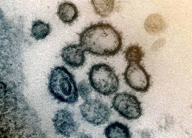 A transmission electron microscope image of SARS-CoV-2, the virus that causes COVID-19. A recent study estimates the incubation period of the virus to be 5.1 days. (Photo: NIAID-RML)