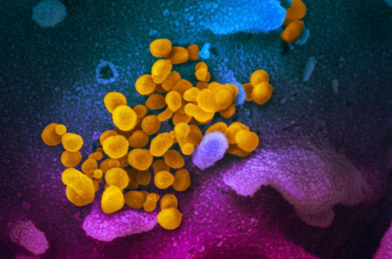 This scanning electron microscope image shows SARS-CoV-2 (yellow)--also known as 2019-nCoV, the virus that causes COVID-19--isolated from a patient in the U.S., emerging from the surface of cells (blue/pink) cultured in the lab. (Photo: NIAID RML)