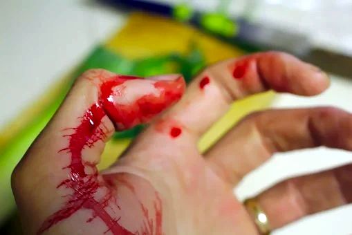Super Glue Made From Snake Venom Can Stop Bleeding in Seconds