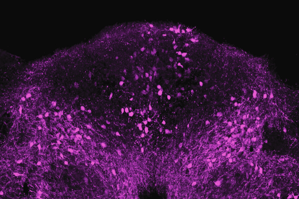 Brain cells that express the neuropeptide ADCYAP1, tagged here with fluorescent protein, induce some sickness behaviors. (Credit: Laboratory of Molecular Genetics at The Rockefeller University)